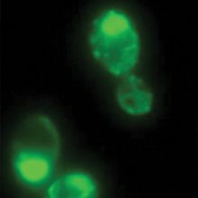 A micrograph of the prion-like state of a protein called Pus4