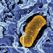 Microscopic view of salmonella 