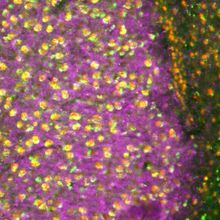 The image shows a brain section of the mouse amygdala. Using fluorescent markers, the expression of synapses is shown in purple, while neurons are shown as red dots and the microRNA miR-483-5p is shown as green dots.