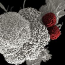 electron micrograph of grey cancer cell, with two red T cells stuck to the side