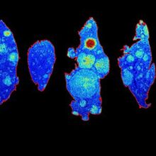 An image of lung tissue acquired using a MALDI imaging mass spectrometer.