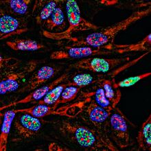 Immunofluorescence light microscopy image of cancer cells growing in 2D with nuclei in blue, cytoplasm in red, and DNA damage foci in green.