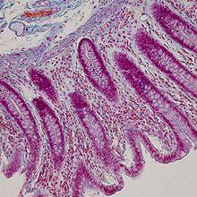 A microscopy image of intestinal crypts in human tissue.