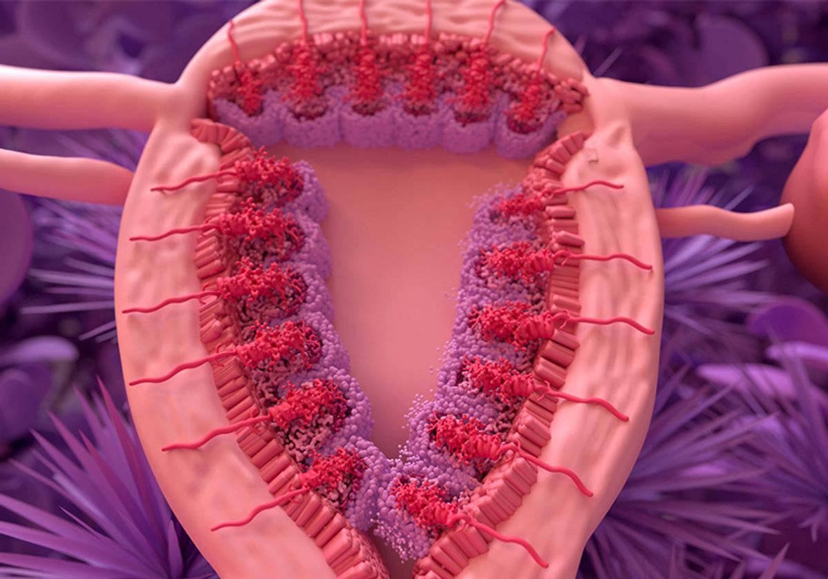 Stylized uterine cross section, showing endometrial layers and buildup of the uterine lining before menstruation.