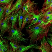 Fluorescence microscopy image of fibroblasts in culture.