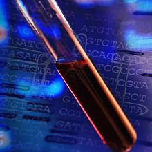 Image of blood in a test tube with the four base pairs of DNA in the background.