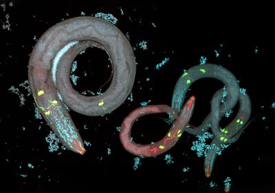 Image of Caenorhabditis elegans against a black background.