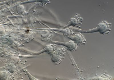 Brightfield microscopy image of Aspergillus fumigatus.