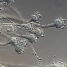 Brightfield microscopy image of Aspergillus fumigatus.