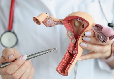 A doctor holds a model of the female reproductive system.