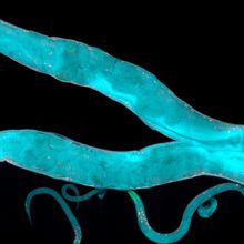 Fluorescent microscopy image of two adult&nbsp;<em >C. elegans</em> and several offspring.