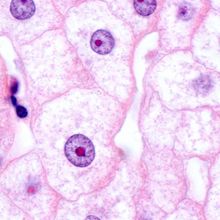 Microscopy image of hepatocytes stained in pink with purple nuclei.