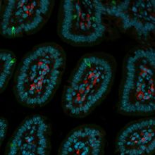 Fluorescent microscopy image with a black background and blue, green, and red colors marking different cells.