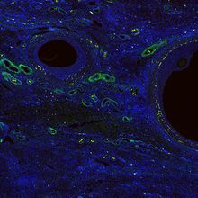 Microscopy image of an ovary labeled with blue, green, and yellow fluorescent markers.