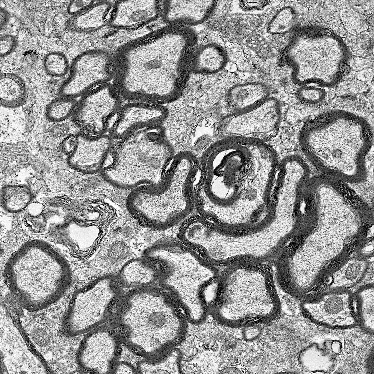 Dysregulated myelin in FIRE mice.