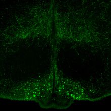 A cross-section of a mouse hypothalamus, where cells of the arcuate nucleus are shown in bright green at the bottom.