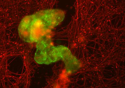 Image of aggregated anthrobots (green) forming a bridge between two neuronal cells (red).