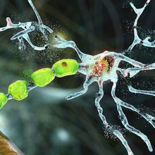 A conceptual 3D illustration of motor neurons degrading