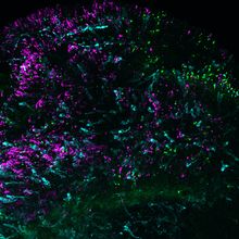 Image of retinal organoid showing blue cones in cyan and green/red cones in green. Rod cells are marked in magenta.