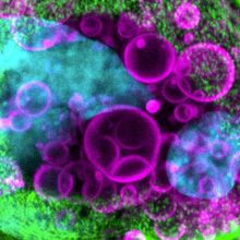 Larger green cell with two cyan spots and many smaller magenta circles in and around the cell.&nbsp;