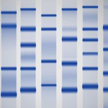 A gel with dye-labeled bands indicating proteins separated by electrophoresis.