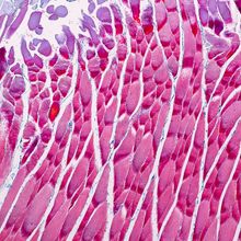 Education anatomy and Histological sample Striated (Skeletal) muscle of mammal Tissue under the microscope.