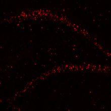 A brain section showing the mouse hippocampus. RNA molecules are shown in red.