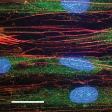 Immunofluorescence image of human tenocytes (cell nuclei in blue, actin in red) with PIEZO1 protein labeled in green (Scale bar: 20 ?m)