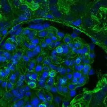 fuorescence microscopy of kidney tissue