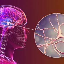 A pink and blue illustration of the central nervous system, visible through a translucent outline of a human head and shoulders, zooms in to show an illustration of interconnected neurons