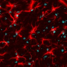 Fluorescence microscopy imaging of astrocytes in culture, stained red