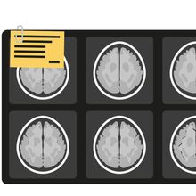 illustration of multiple brain scan images