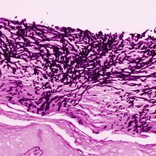 Microscope visualization of Candida albicans in an esophageal sample from a rhesus monkey with thrush