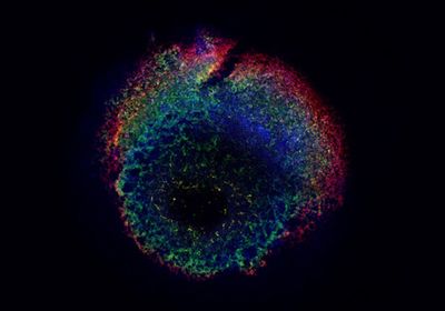 Multicolored microscopy image of a blood generating-heart forming organoid on a black background, showing the various cell types that make up the organoid.