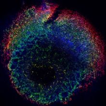 Multicolored microscopy image of a blood generating-heart forming organoid on a black background, showing the various cell types that make up the organoid.