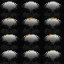 Images from a novel brain imaging technique, DIANA