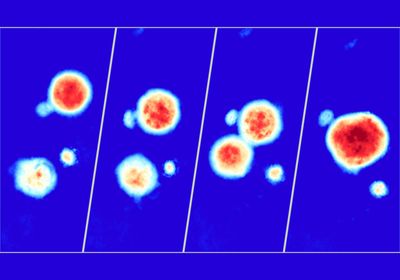 Images of tumor organoids acquired using high-speed live cell interferometry.