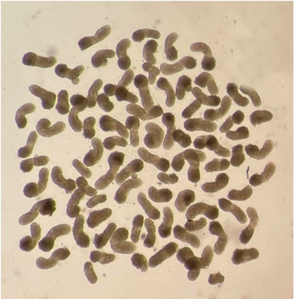 Image of comma-shaped cell aggregates.