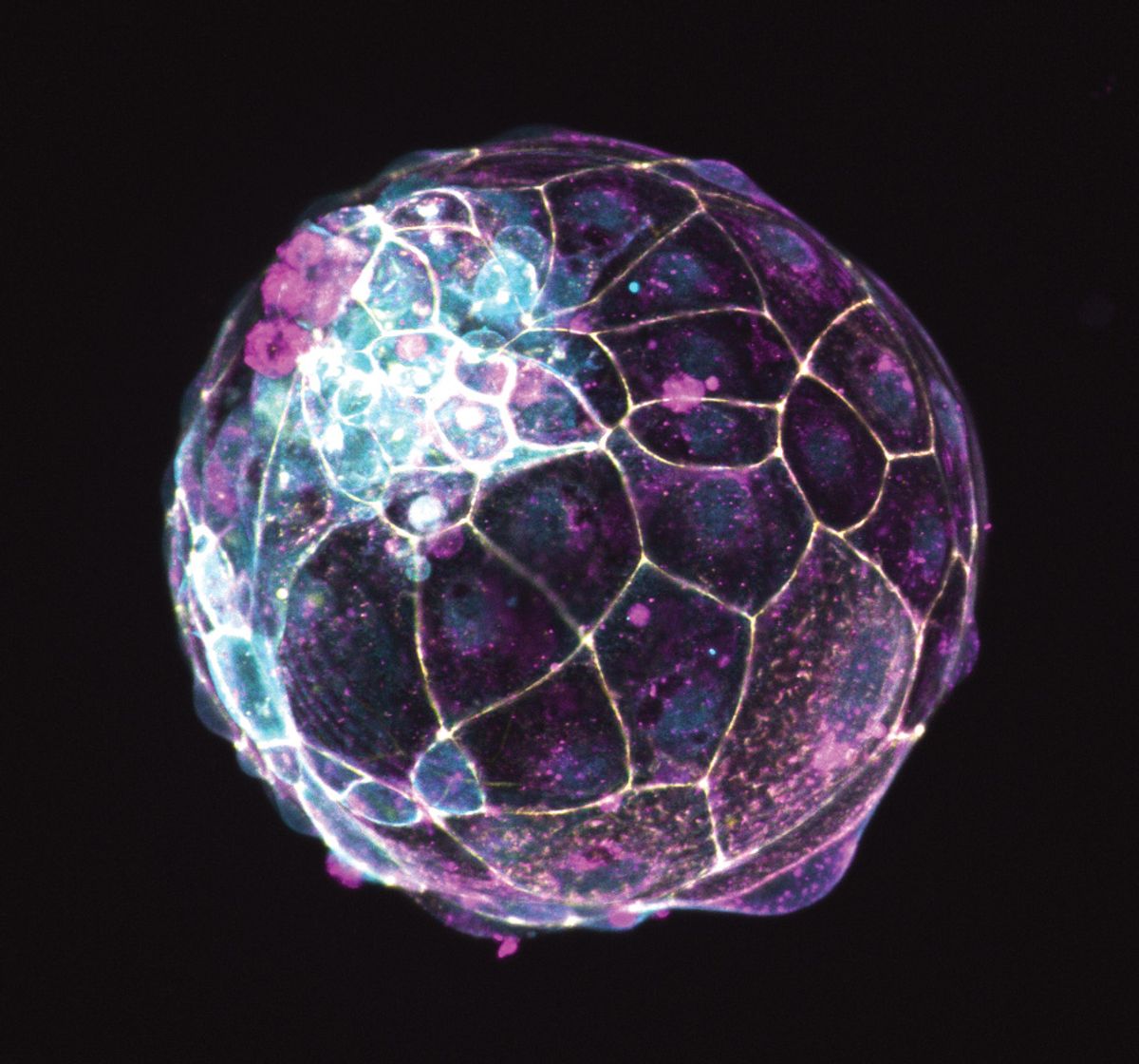 Fluorescent image of a blastoid with yellow, magenta, and cyan labels.