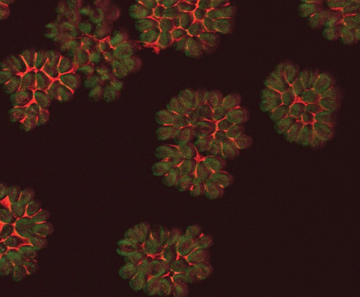 a microscopy image of Botryococcus braunii in green and red.