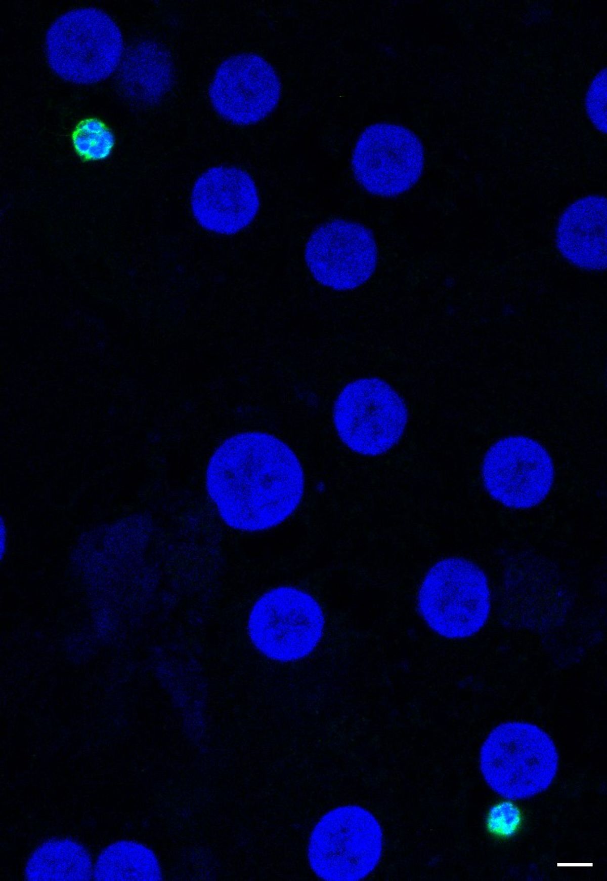 Blue circles and one bright green circle on a black background.