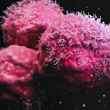 An illustration of malignant cancer cells in pink on a black background.