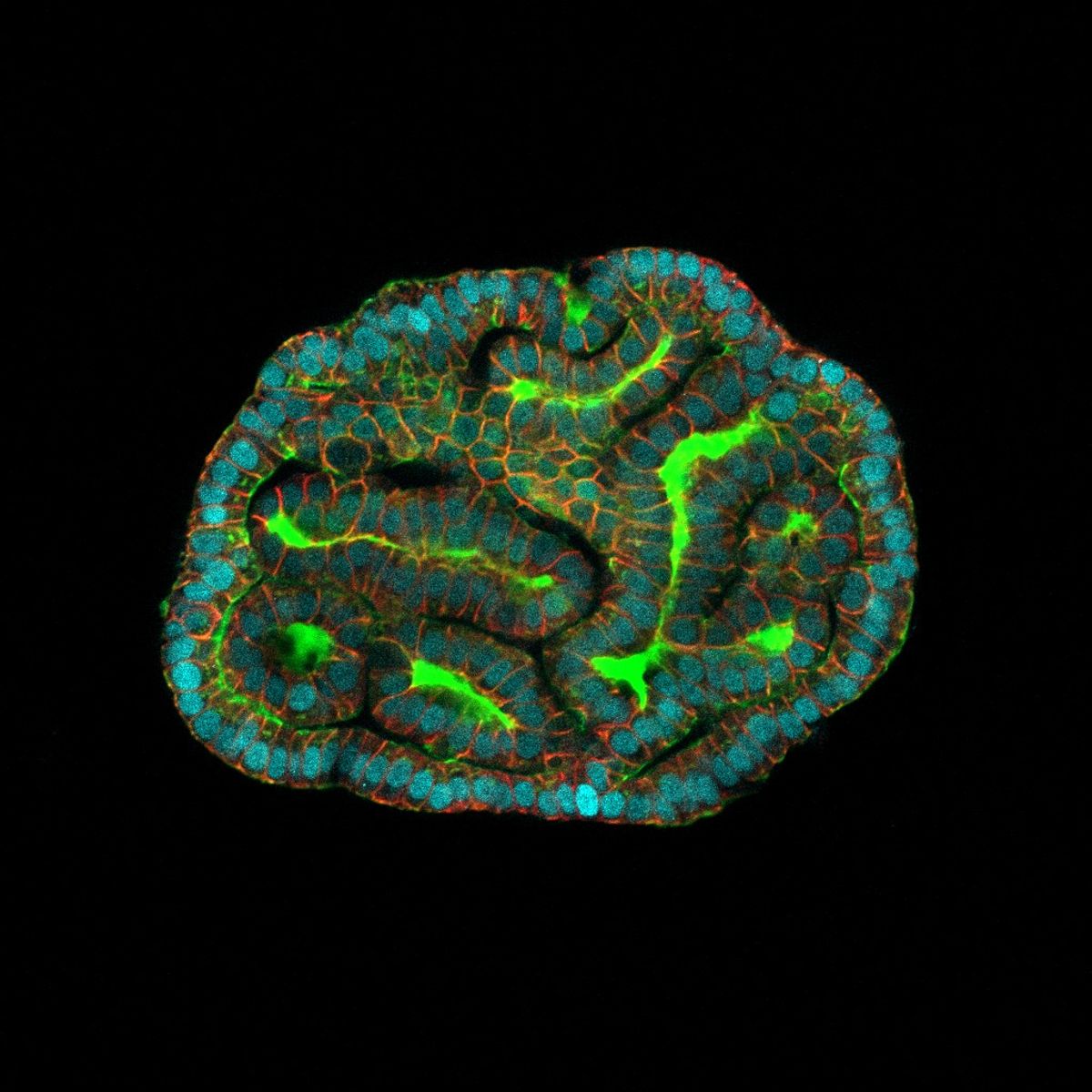 Cluster of blue cells encasing green tube structures.