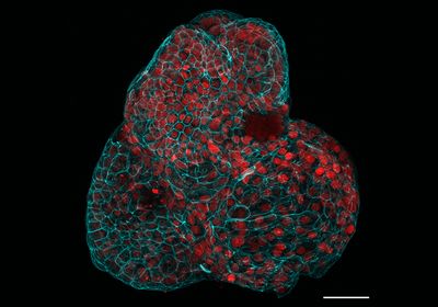 Red cells encased in cyan webbing.&nbsp;