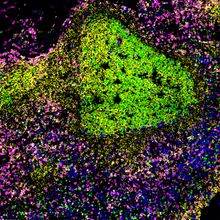 Fluorescence image in purple and green of lymph node