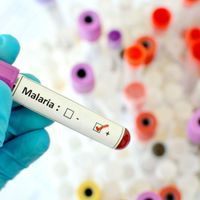 gloved hand holding test tube of blood with a label marking the sample as positive for malaria. There are tubes with lids of various colors in the background. 