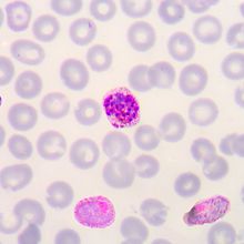 Pink and purple <em>Plasmodium</em> parasites inside red blood cells