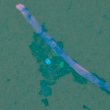 Close-up of a fiber with brightly colored pathogens beside it