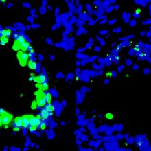 Group of cells stained in either blue or green in a black background.