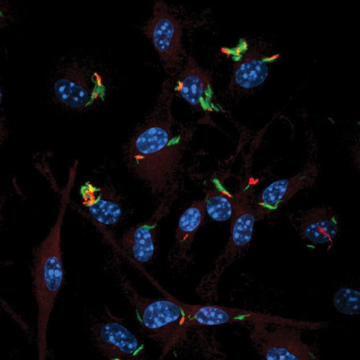 Cells infected with the pathogen Mycobacterium tuberculosis.